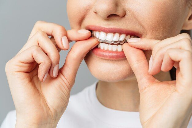 Premium Photo _ A young woman does a home teeth whitening procedure whitening tray with gel